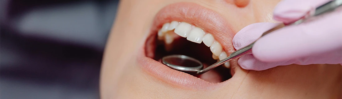 Cancer-Focused Dentistry in Tacoma WA